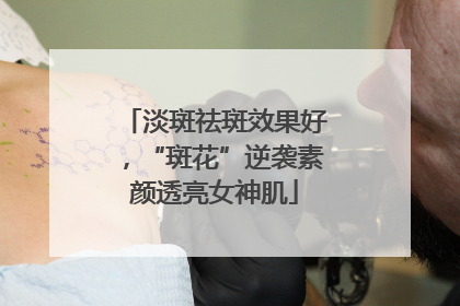 淡斑祛斑效果好，“斑花”逆袭素颜透亮女神肌